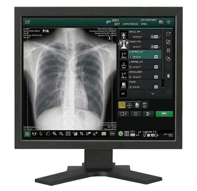 呼吸器疾患(呼吸器科) - 田中クリニック(医療法人社団 佐介会)